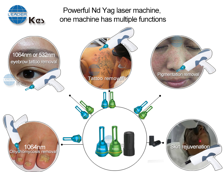 KES factory Big Discount Q Switch Nd Yag Laser Two ND YAG LASER BAR tattoo removal machine MED 810A