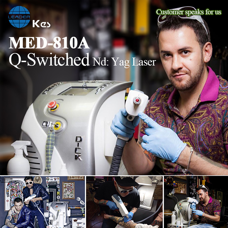 KES factory Big Discount Q Switch Nd Yag Laser Two ND YAG LASER BAR tattoo removal machine MED 810A
