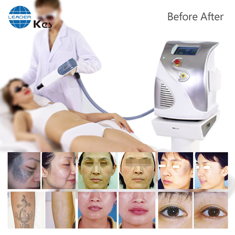 KES factory Big Discount Q Switch Nd Yag Laser Two ND YAG LASER BAR tattoo removal machine MED 810A