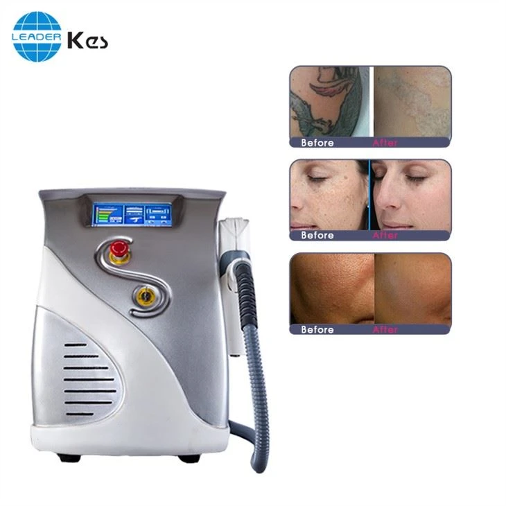 Carbon Peeling Machine Professional Machine
