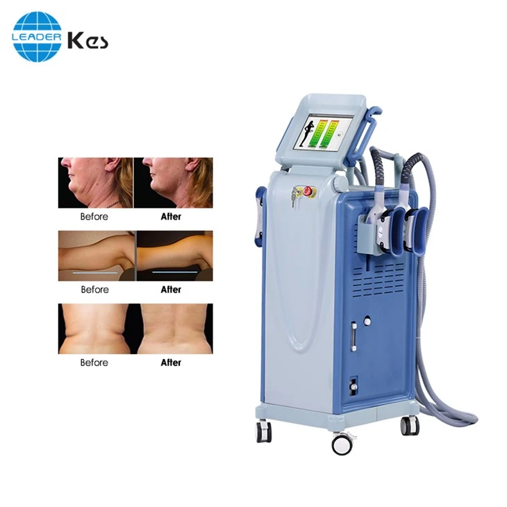 Slimming Cryolipolysis